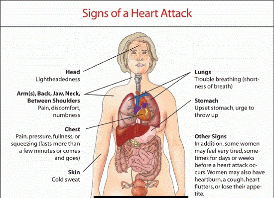 Signs of heart attack